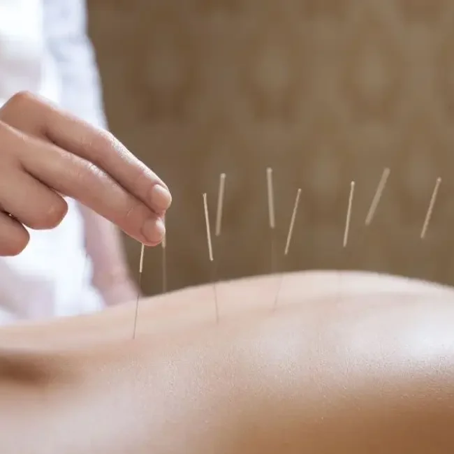 service zh 9 acupuncture in markham