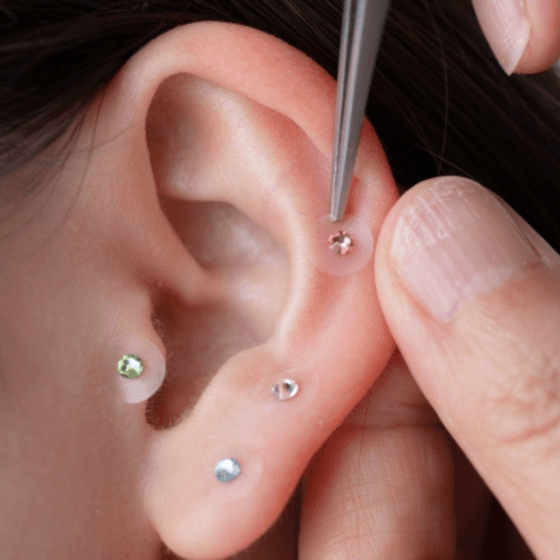 earseed therapy